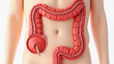 hirschprungova choroba příznaky a léčba – Jak poznat a léčit Hirschprungovu chorobu: příznaky a možnosti léčby