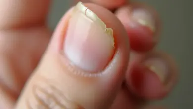hrbolaté nehty na rukou příčiny a řešení – Jak řešit hrbolaté nehty na rukou a co je způsobuje