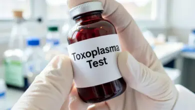 toxoplazmóza příznaky a prevence - Příznaky toxoplazmózy a prevence nákazy: Co potřebujete vědět