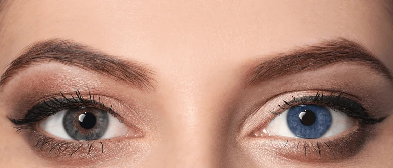 Dvě různé barvy očí - heterochromie u ženy s make-upem