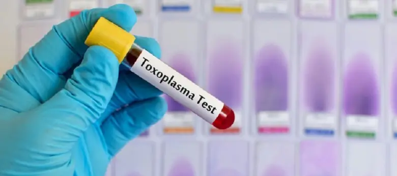 Krevní vzorek pro diagnostiku toxoplazmózy