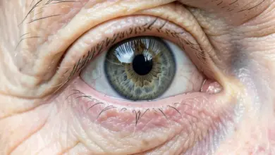 Jak poznat a léčit šedý zákal - ilustrační foto