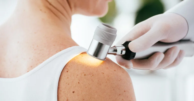 Lékař zkoumá skvrny na kůži pomocí dermatoskopu.