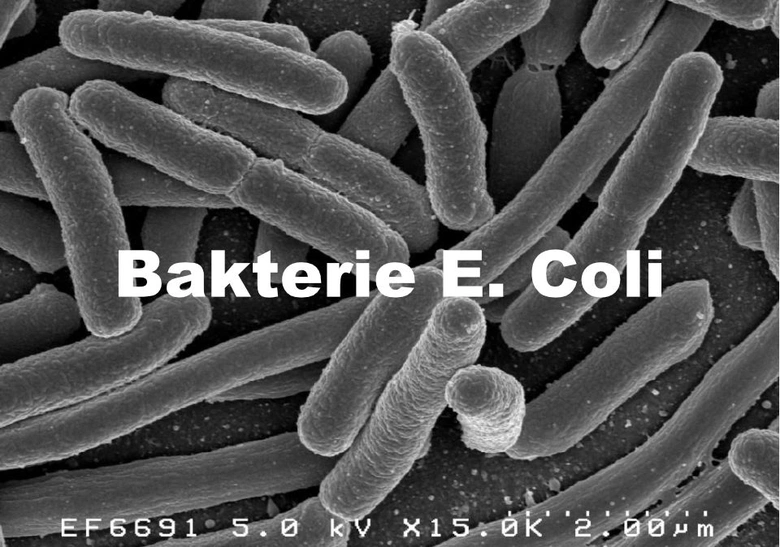 Elektronový mikroskopický záběr na bakterie Escherichia coli.