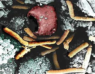 Bacillus anthrax bakterie s endospory na povrchu infikované buňky.