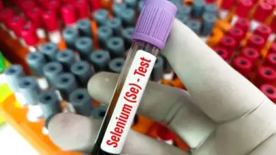 Ruka drží zkumavku na krevní test selenu s fialovou zátkou.