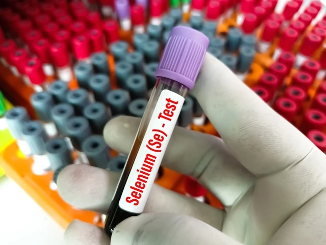 Ruka drží zkumavku na krevní test selenu s fialovou zátkou.