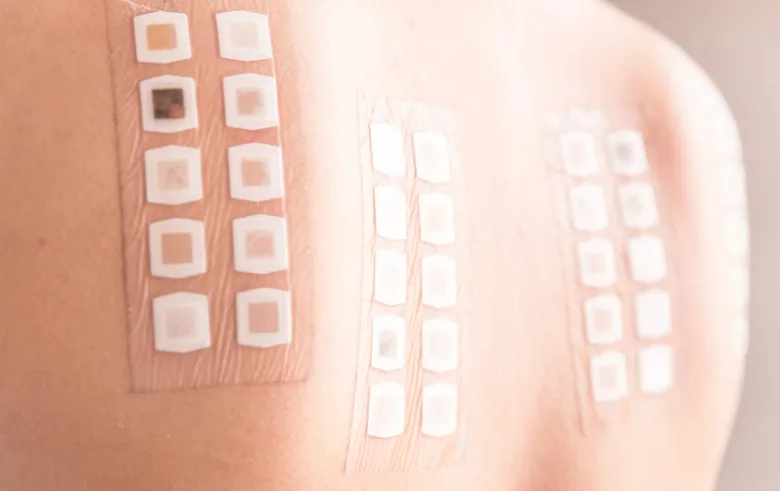 Alergické testovací patche na kůži pro diagnostiku alergií
