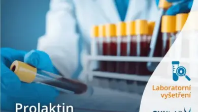Laboratorní test prolaktinu s krevními vzorky ve skleněných zkumavkách.