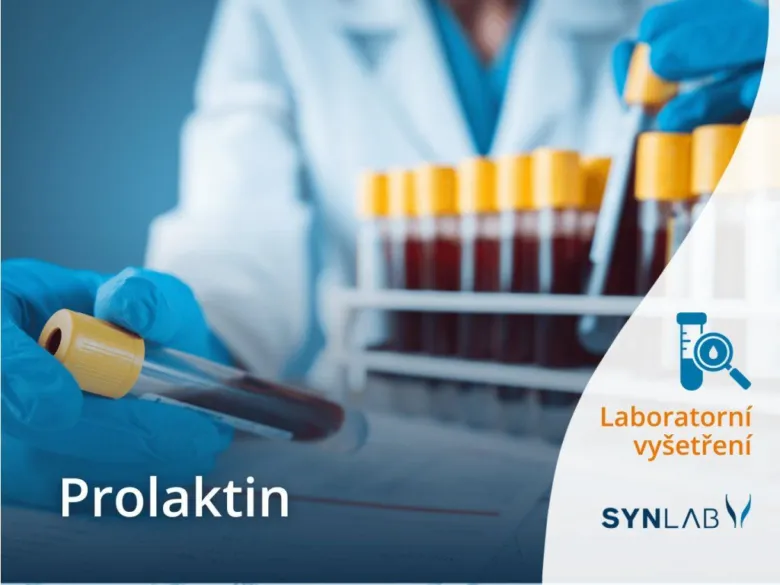 Laboratorní test prolaktinu s krevními vzorky ve skleněných zkumavkách.