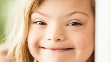 Usměvavé dítě s Downovým syndromem se zlatými vlasy.