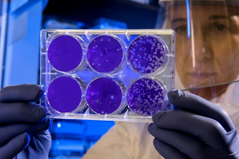 Vědec drží desky s bakteriemi v laboratoři.