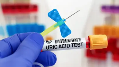 Ruka drží zkumavku na kyselinu močovou s jehlou v laboratoři.