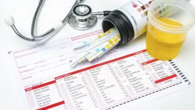 Kontejner s testovými proužky na moč, krevní tlakoměr a vzorek moči.