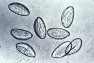 Mikroskopický pohled na vejce pinwomu Enterobius vermicularis.