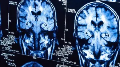 MRI snímky mozku pro diagnostiku nádorů