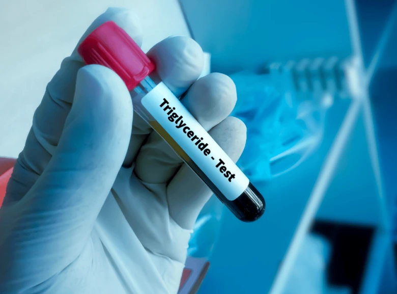 Ruka drží zkumavku s krví pro test triglyceridů.