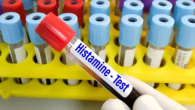 Krevní vzorek pro test histaminu držený rukou
