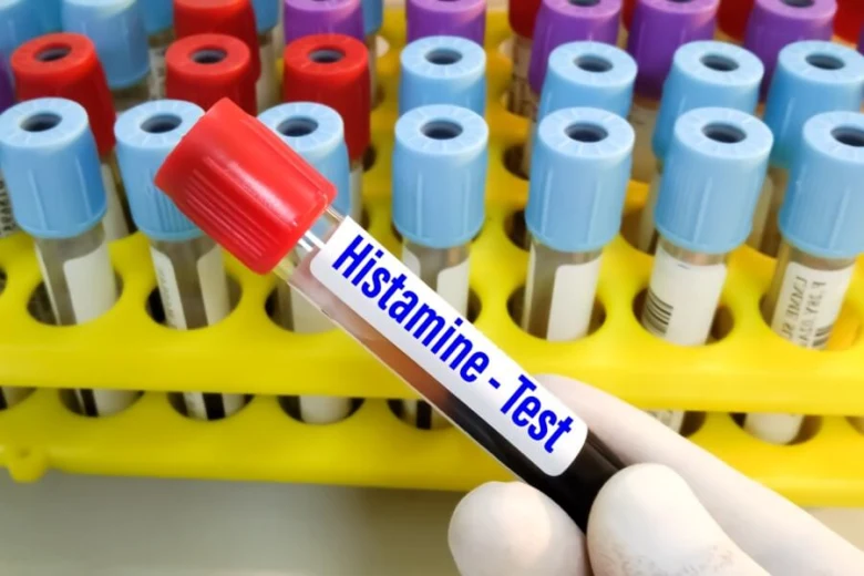 Krevní vzorek pro test histaminu držený rukou