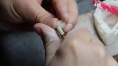 Zubní lékař upravuje zubový model pomocí malého nástroje.