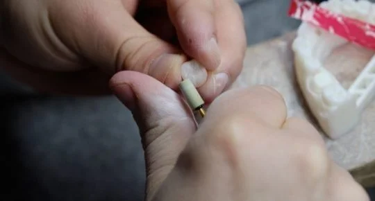 Zubní lékař upravuje zubový model pomocí malého nástroje.