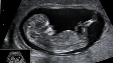 Ultrazvukový snímek plodu v 12. týdnu těhotenství.