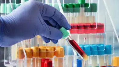 Ruka v rukavicích drží zkumavku s krví na laboratorním stojanu.