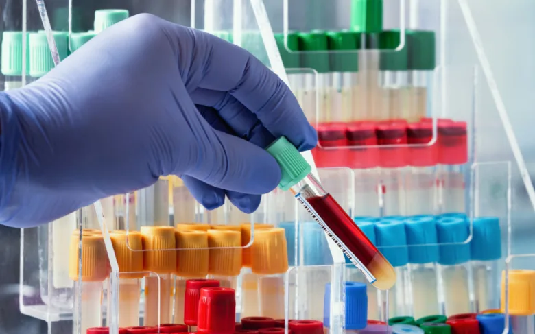 Ruka v rukavicích drží zkumavku s krví na laboratorním stojanu.