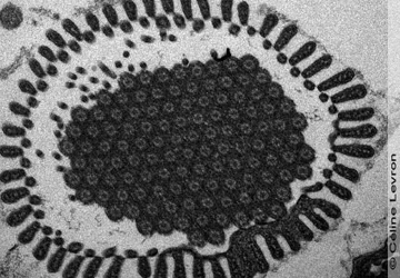 Parasite cross-section electron micrograph