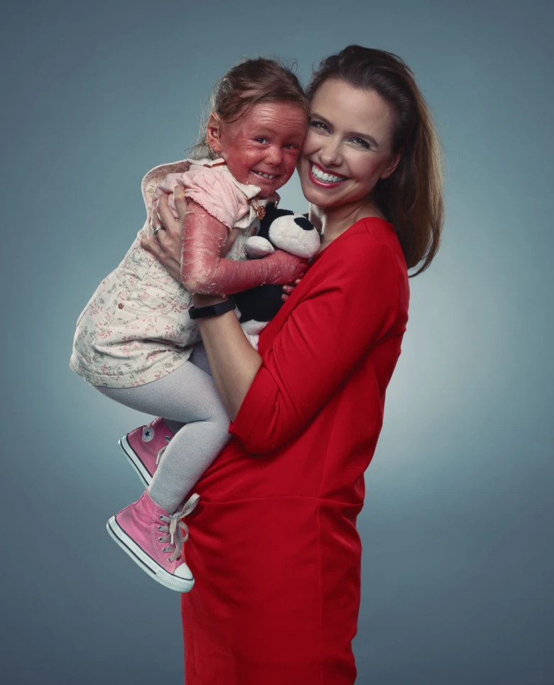 Dívka s těžkou rybí kůží v náručí matky