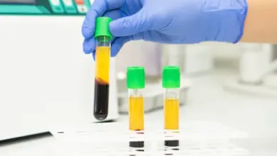 Ruce v rukavicích drží zkumavku s krví pro analýzu hemostázy.
